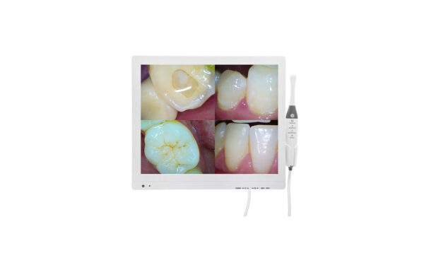 DS Dental Ağız içi Kamera
